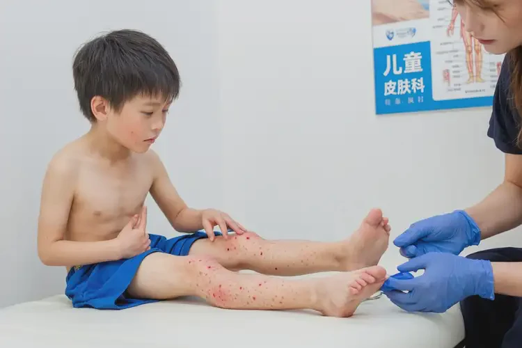 小孩大腿上容易長(zhǎng)濕疹可不可以徹底自愈(圖3)