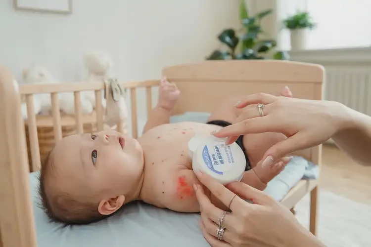 寶寶大腿上容易長濕疹能徹底自愈嗎(圖3)