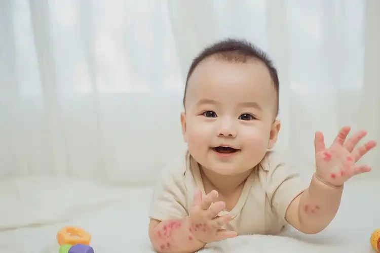 婴儿手臂偶尔起湿疹可以彻底自愈吗(图3)