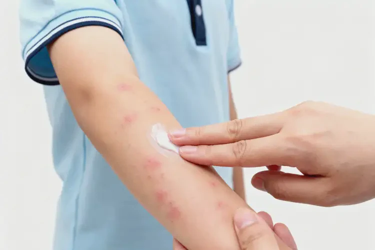 小學(xué)生手臂上出濕疹可不可以徹底自愈(圖3)