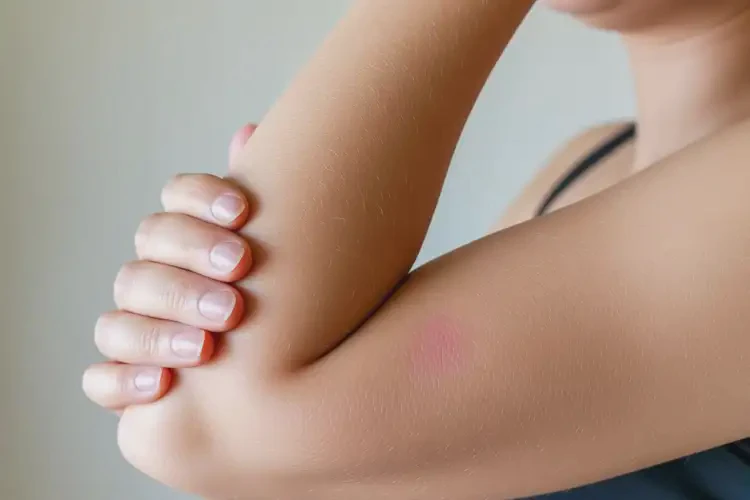 青年人手臂容易起濕疹不管它會(huì)自己自愈嗎(圖1)