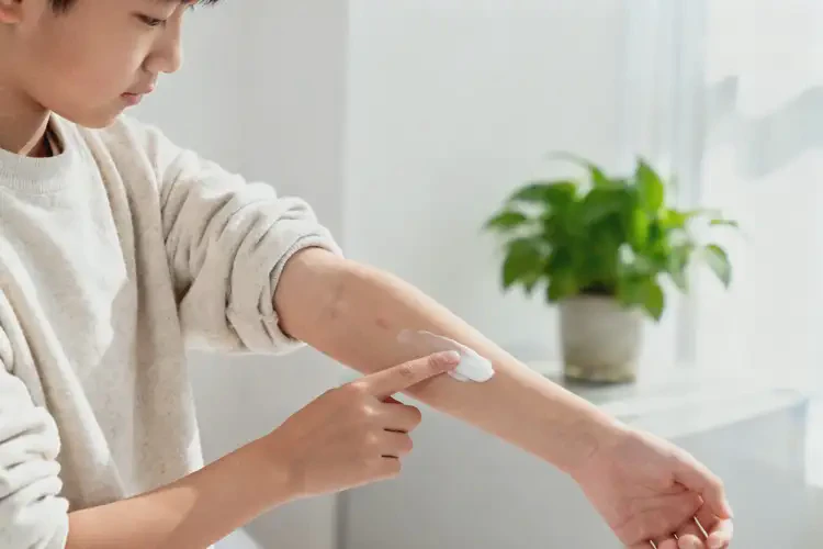 中學生身上經(jīng)常起濕疹能夠徹底治愈嗎(圖4)