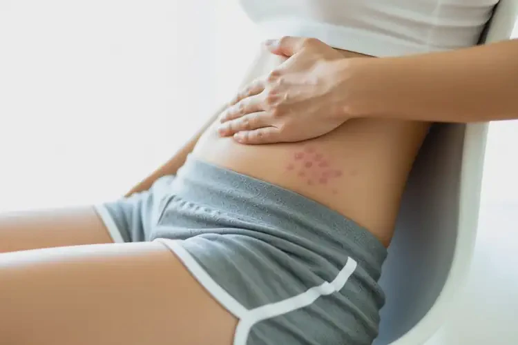 女性肚子經(jīng)常長(zhǎng)濕疹能靠自己自愈嗎(圖3)