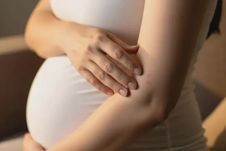 孕婦手臂上起濕疹能靠自己自愈嗎(圖3)