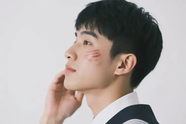 大學(xué)生臉上出現(xiàn)濕疹不管它會(huì)自己好嗎(圖1)