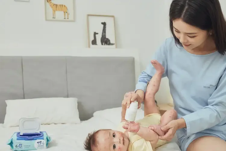 嬰幼兒手臂偶爾起濕疹能靠自己自愈嗎(圖3)
