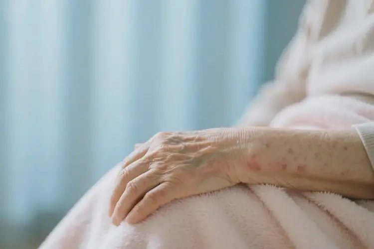 老年人身上偶爾長濕疹能不能徹底自愈(圖1)