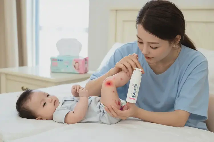 嬰兒大腿長濕疹能靠自己自愈嗎(圖3)