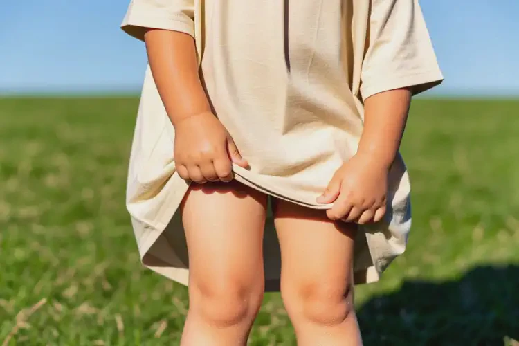 兒童四肢有濕疹能夠徹底治愈嗎(圖1)