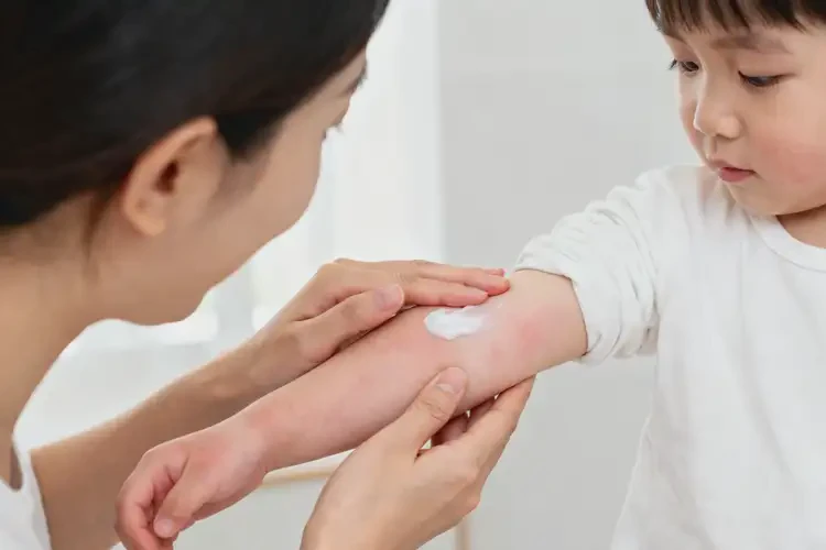 小儿手臂上出湿疹不管它会自己自愈吗(图1)