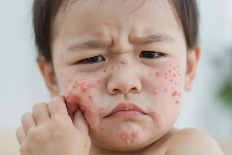 幼兒身上長(zhǎng)濕疹不管它會(huì)自己好嗎(圖4)