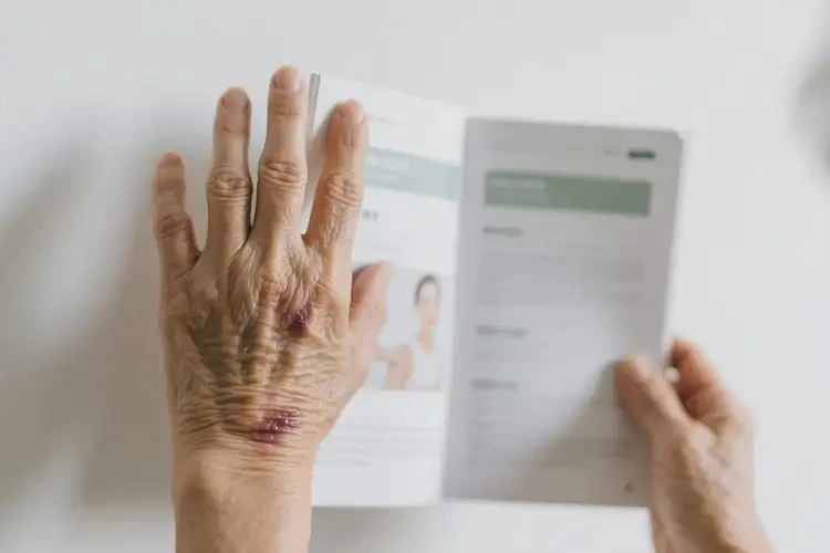 老年人身上容易长湿疹不管它会自己痊愈吗(图2)