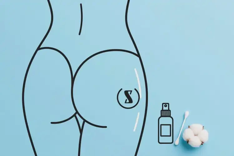 女生屁股上經(jīng)常起濕疹不管它會自己好嗎(圖2)