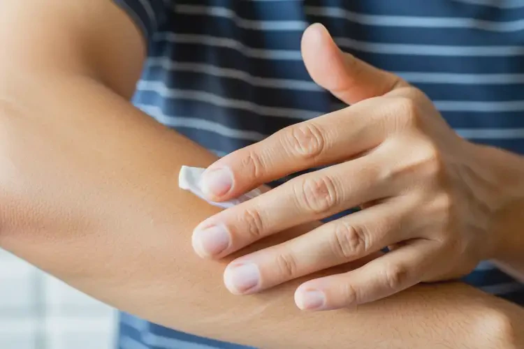 男人手臂起濕疹能不能徹底自愈(圖2)