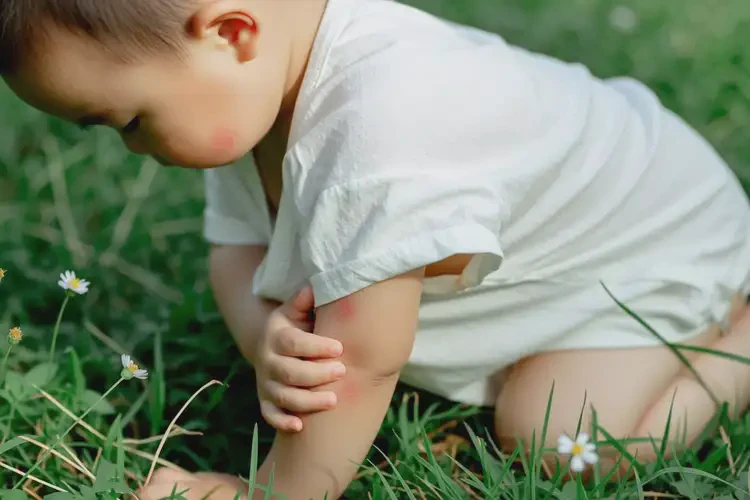 小孩全身長(zhǎng)濕疹可不可以徹底自愈(圖2)