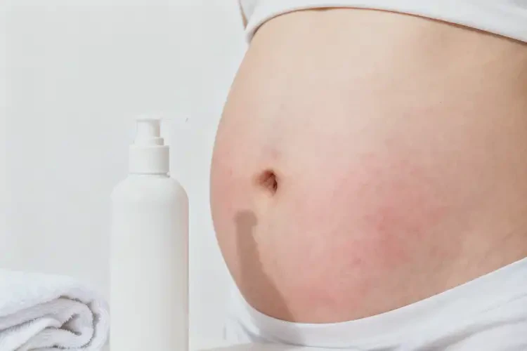 女生肚子容易長濕疹不管它會自己痊愈嗎(圖2)