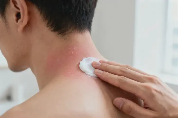 男人脖子經(jīng)常長(zhǎng)濕疹可以徹底自愈嗎(圖2)