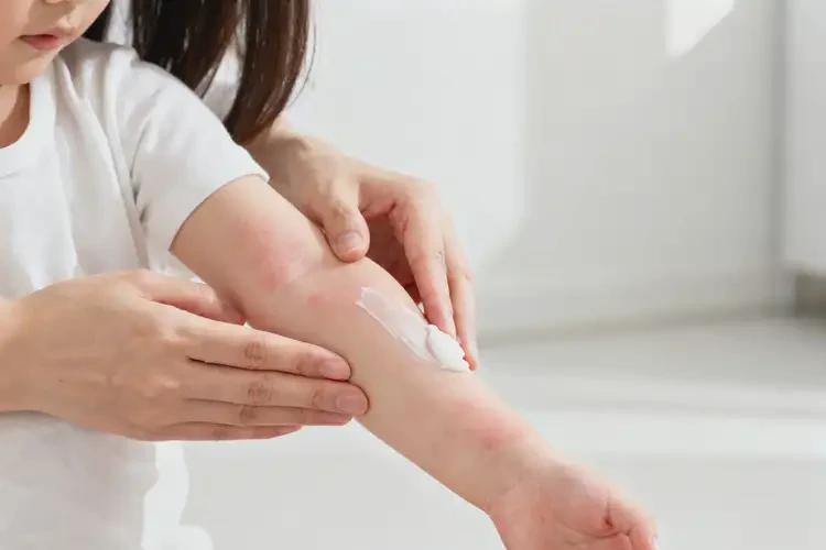 小儿手臂上出湿疹不管它会自己自愈吗(图2)