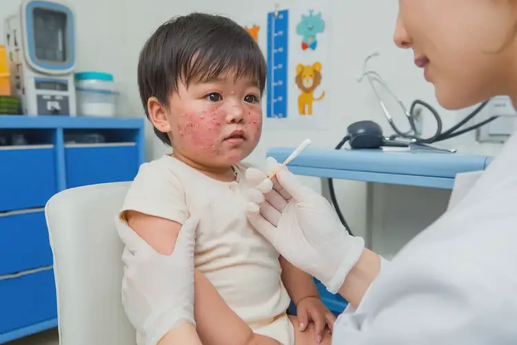 幼兒身上長(zhǎng)濕疹不管它會(huì)自己好嗎(圖3)