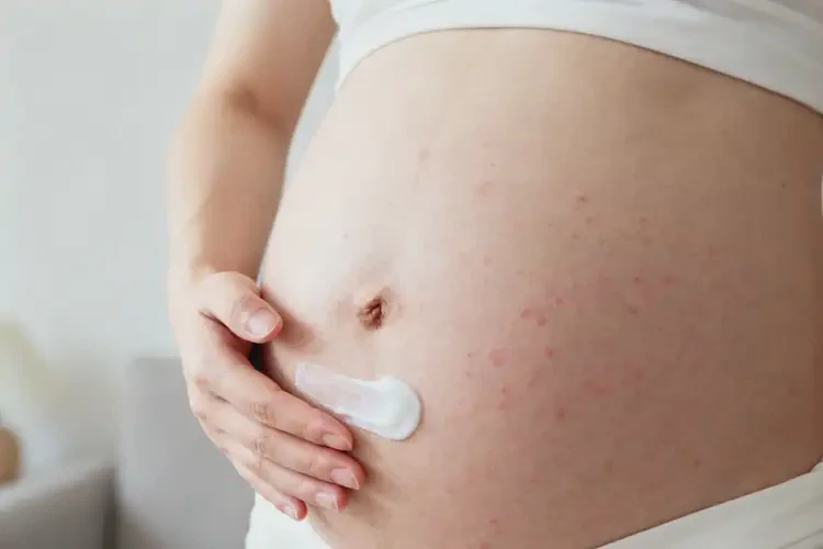 孕婦肚子上容易長濕疹不管它會(huì)自己好嗎(圖3)