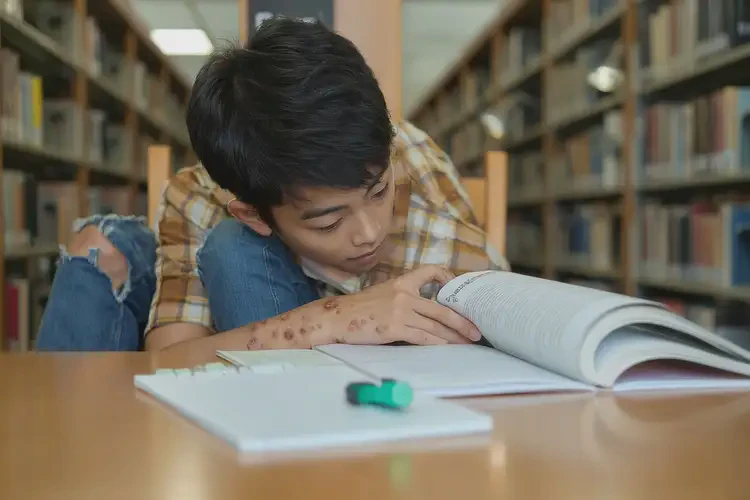 大學生小腿有濕疹能夠徹底治愈嗎(圖4)