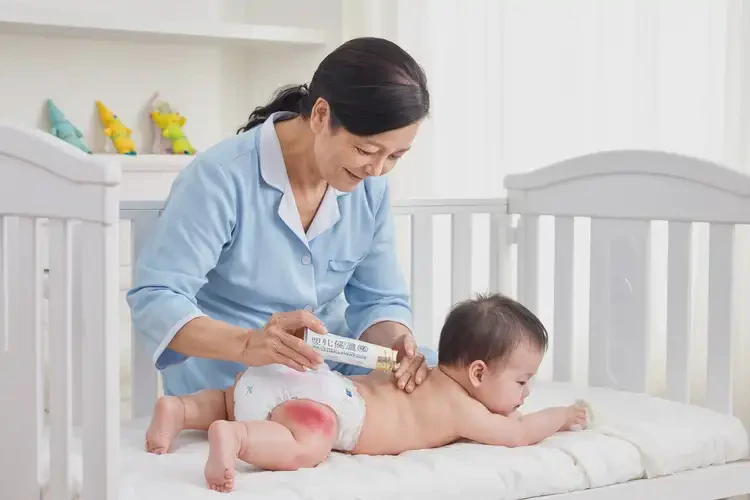 小孩屁股上容易長(zhǎng)濕疹不管它會(huì)自己好嗎(圖3)