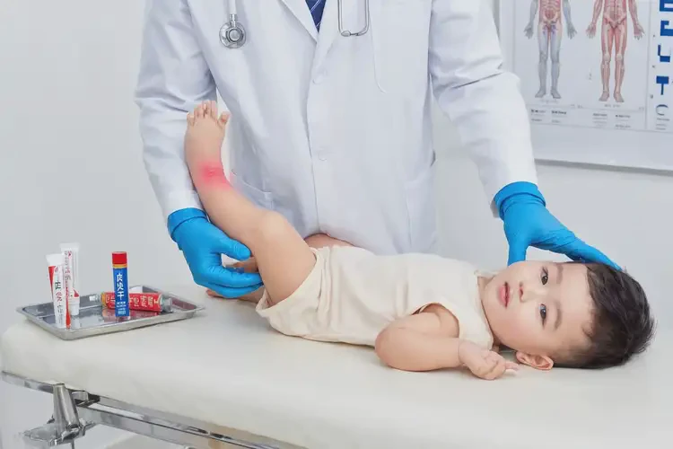 幼兒腳上偶爾長濕疹能靠自己自愈嗎(圖1)