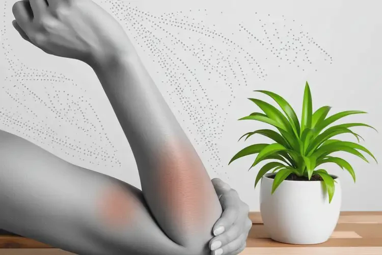 女性手臂容易長濕疹不管它會(huì)自己痊愈嗎(圖1)