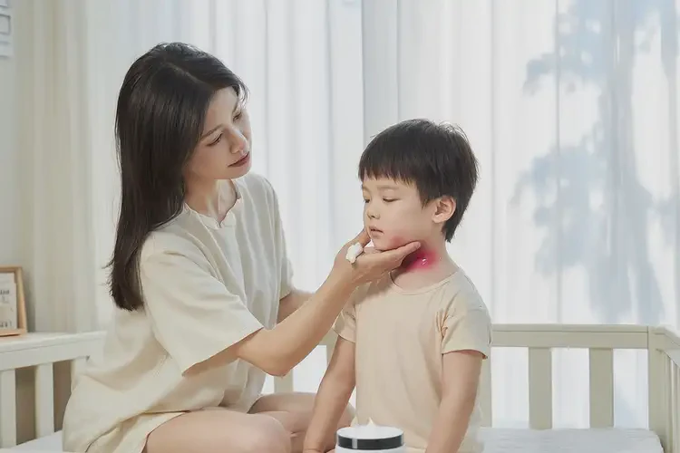 少兒脖子出現(xiàn)濕疹可以徹底自愈嗎(圖3)