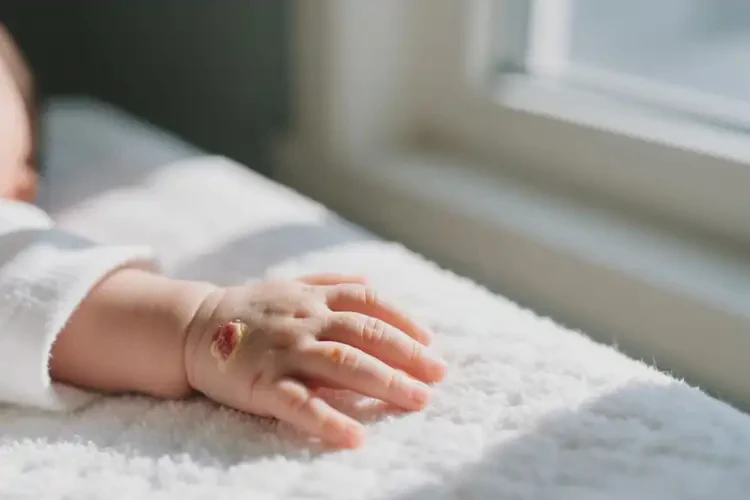 新生兒手上容易起濕疹能靠自己自愈嗎(圖3)