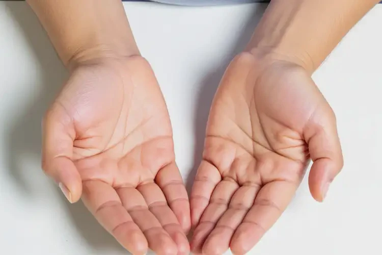 產婦手上容易長濕疹不管它會自己自愈嗎(圖3)