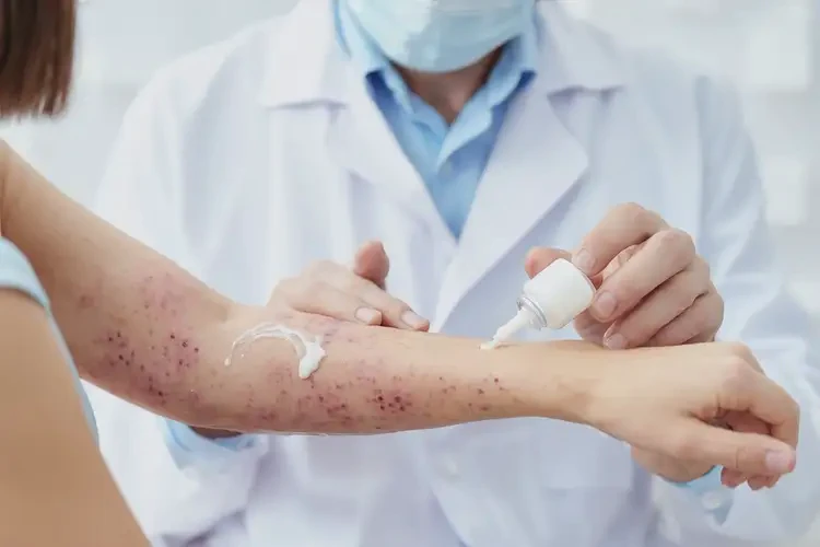 女生手臂出濕疹可不可以徹底自愈(圖3)