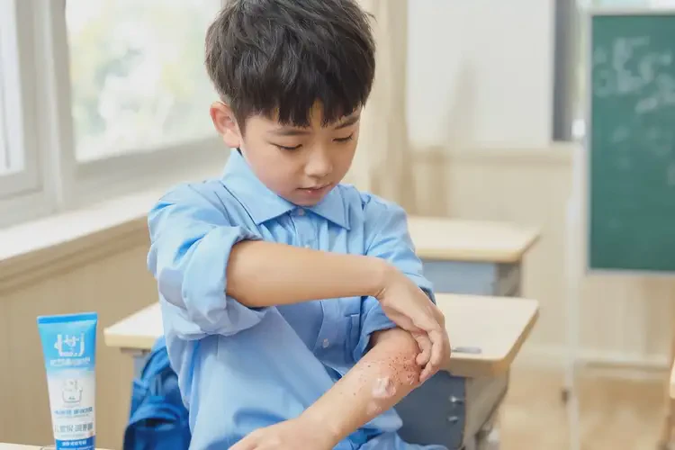 小學生臉上出現(xiàn)濕疹不管它會自己好嗎(圖2)