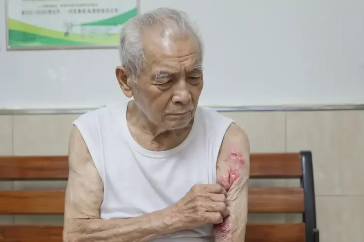 老人手臂上起濕疹不管它會(huì)自己痊愈嗎(圖4)