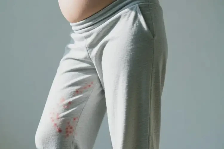 孕婦大腿經(jīng)常起濕疹可不可以徹底自愈(圖2)