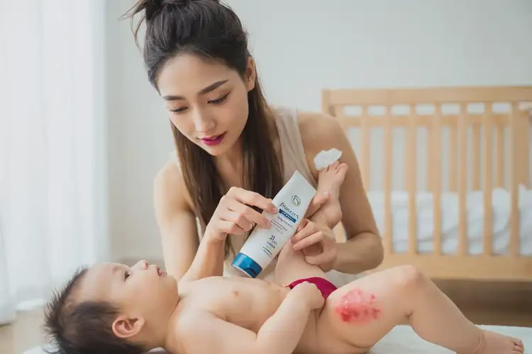 寶寶大腿起濕疹可不可以徹底自愈(圖3)