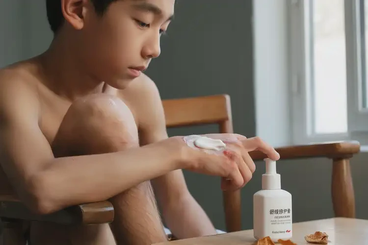 青少年小腿起濕疹能徹底自愈嗎(圖3)