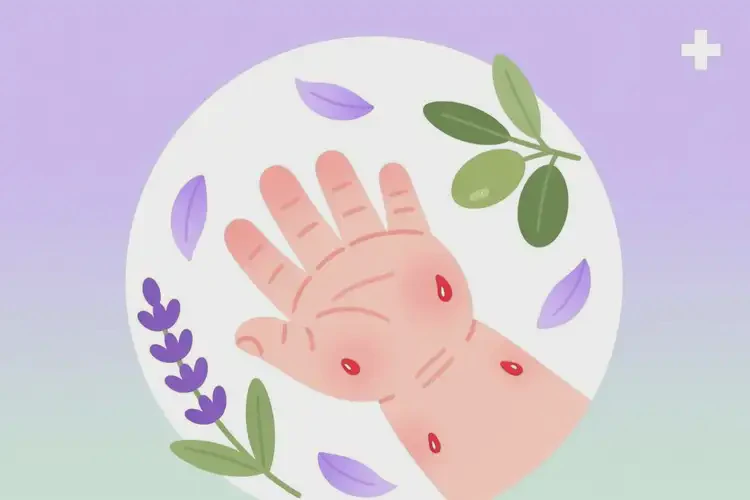 少兒身上經(jīng)常起濕疹不管它會(huì)自己痊愈嗎(圖1)