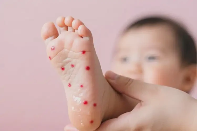 幼兒腳上有濕疹不管它會自己痊愈嗎(圖3)