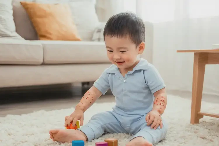 幼兒手臂有濕疹可以徹底自愈嗎(圖2)