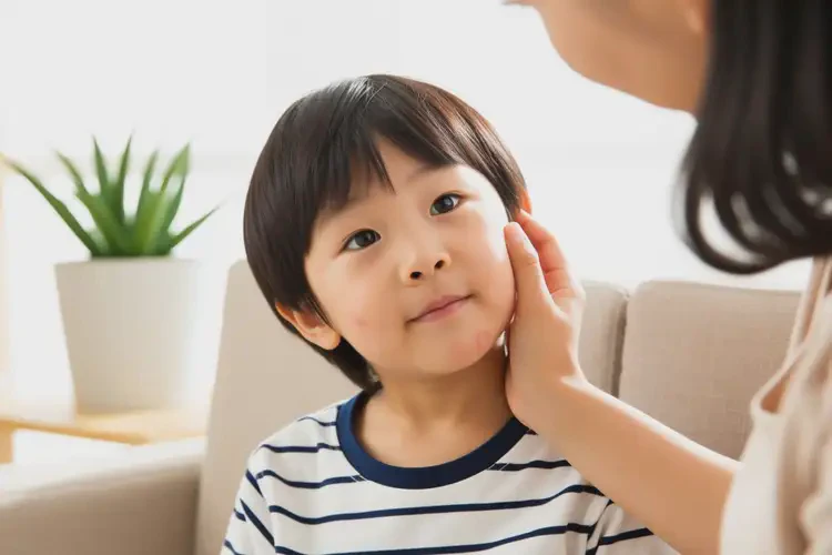 小孩面部經(jīng)常長濕疹能夠徹底治愈嗎(圖4)