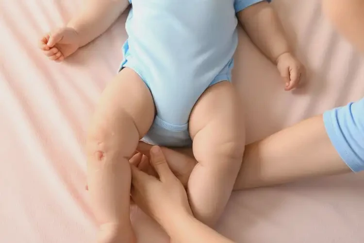 幼兒大腿上出現(xiàn)濕疹不管它會自己好嗎(圖1)