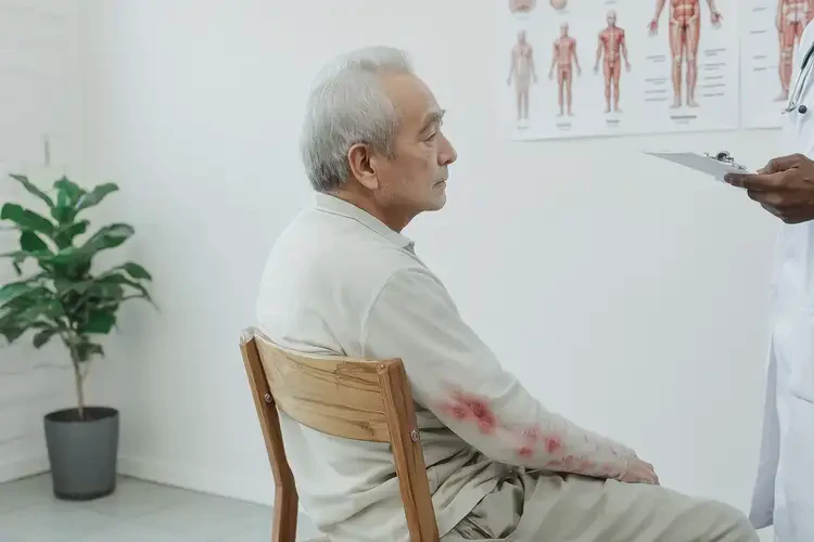 老年人屁股上偶爾長(zhǎng)濕疹不管它會(huì)自己好嗎(圖4)