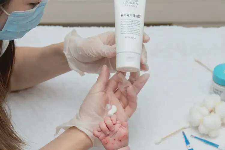 新生兒手上經(jīng)常起濕疹可不可以徹底自愈(圖3)