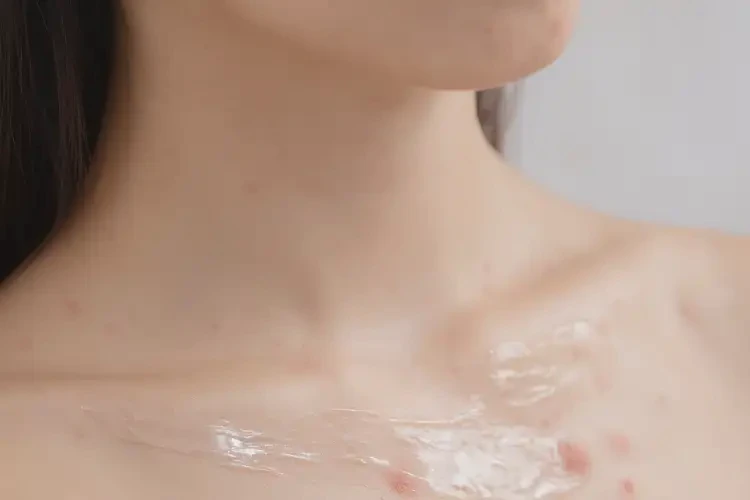 女人脖子偶尔长湿疹不管它会自己自愈吗(图2)