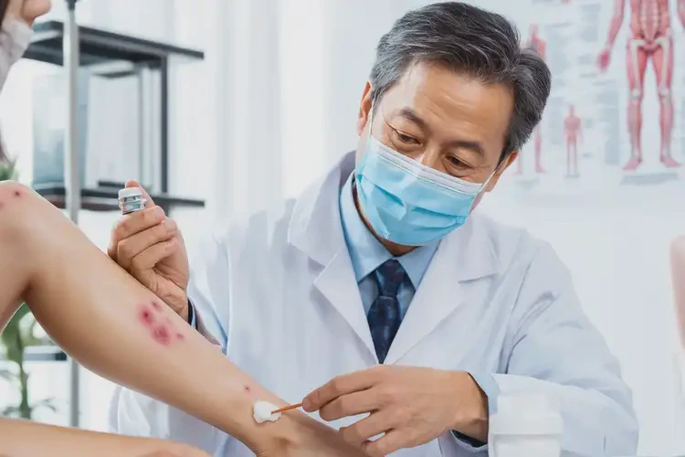 青年人小腿容易長(zhǎng)濕疹不管它會(huì)自己自愈嗎(圖3)