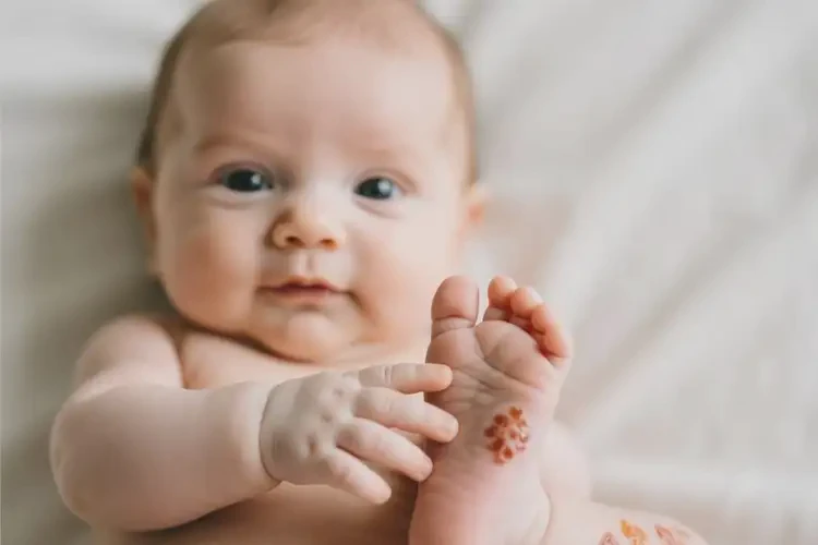 寶寶四肢起濕疹不管它會(huì)自己痊愈嗎(圖1)