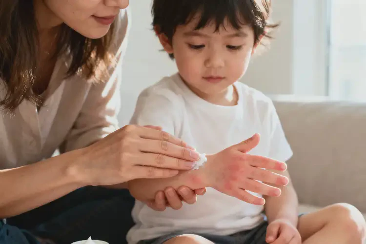 孩子手上出現(xiàn)濕疹不管它會自己好嗎(圖4)