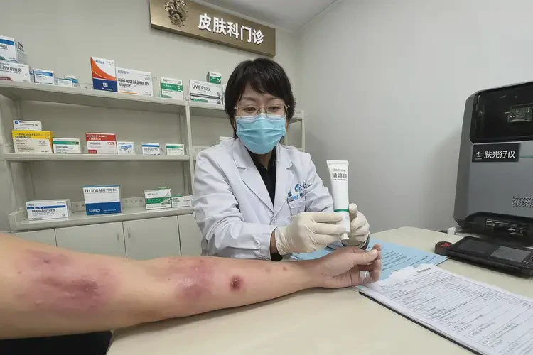 男生身上容易長濕疹不管它會自己自愈嗎(圖3)