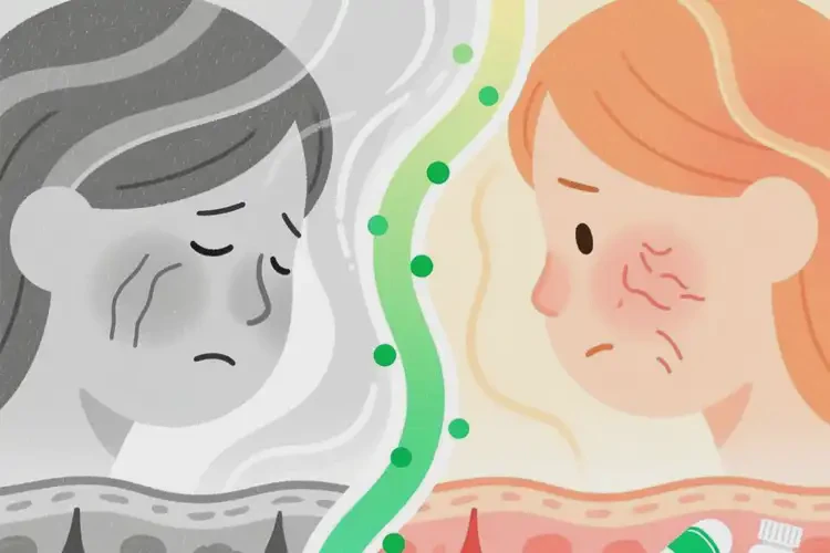 青年人肛周出濕疹可不可以徹底自愈(圖2)